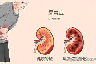 巴克利：我不太信任浓眉&太不稳定 湖人有个39岁的人打得比他好